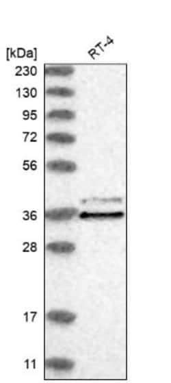 CLNS1A Antibody, Novus Biologicals 25 &mu;L, Unlabeled:Antibodies, Polyclonal